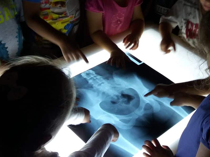 Un Grupo De Niños Observa Una Radiografía En Una Mesa De Luz En Infantil.