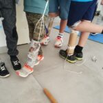 creación de prótesis ortopédica