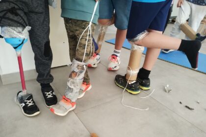 creación de prótesis ortopédica